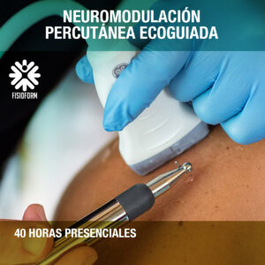 Neuromodulación Percutánea Ecoguiada - Madrid