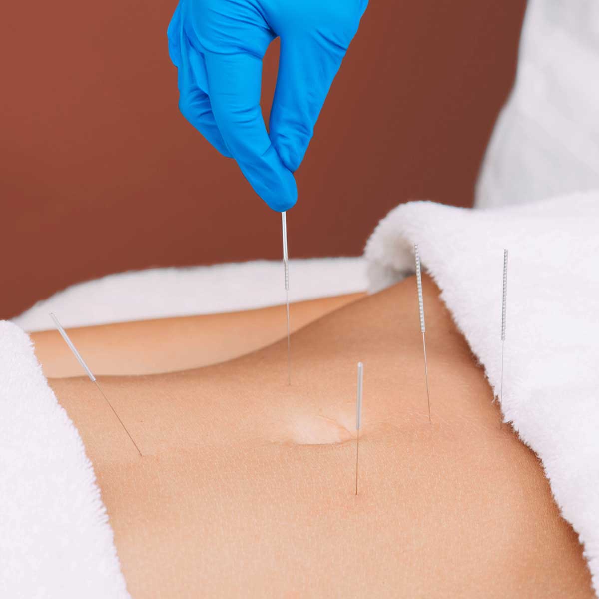 Fisioterapia Invasiva Ecoguiada en el Suelo Pélvico Gran Canaria