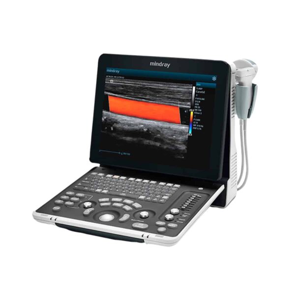 Ecógrafo Mindray Z60